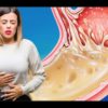 Народные средства от изжоги: 6 проверенных рецептов